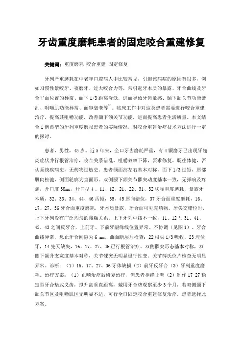 牙齿重度磨耗患者的固定咬合重建修复