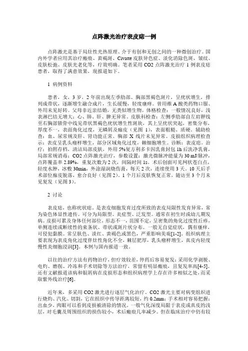 点阵激光治疗表皮痣一例