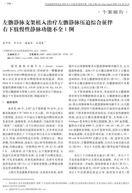左髂静脉支架植入治疗左髂静脉压迫综合征伴右下肢慢性静脉功能不全1例