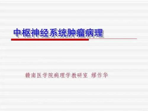 肿瘤诊治技术-中枢神经系统肿瘤