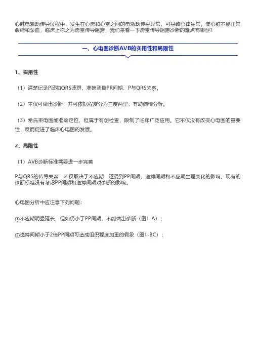 房室传导阻滞心电图分析中应注意的5个问题