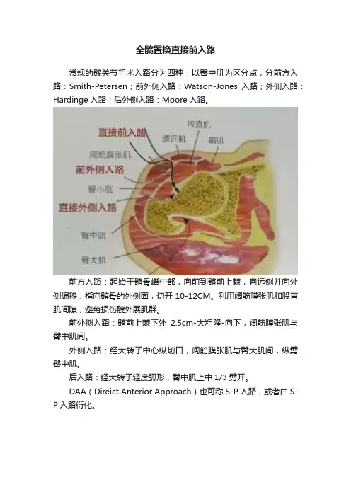 全髋置换直接前入路
