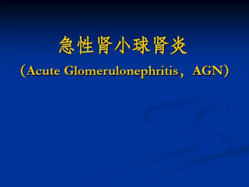 小儿急性肾小球肾炎ppt课件