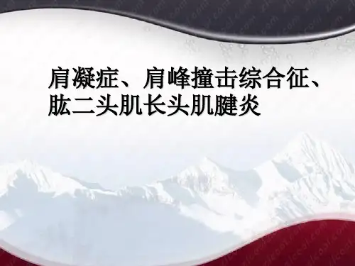 肩凝症、肩峰撞击综合征、肱二头肌长头肌腱炎