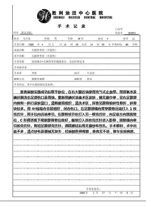 跟骨骨折翘拨复位、克氏针固定术