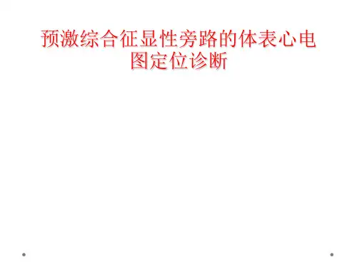 预激综合征显性旁路体表心电图定位诊断
