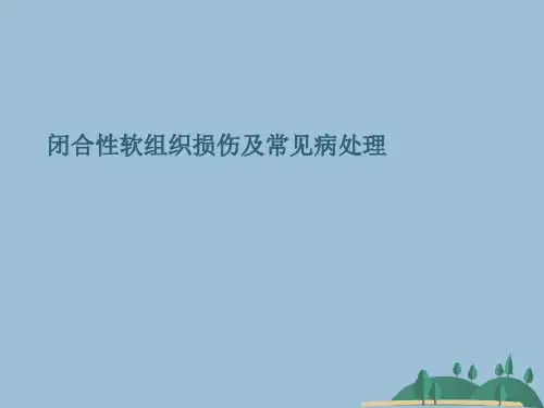 闭合性软组织损伤及常见病处理