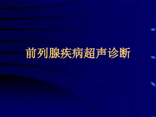 前列腺超声诊断课件