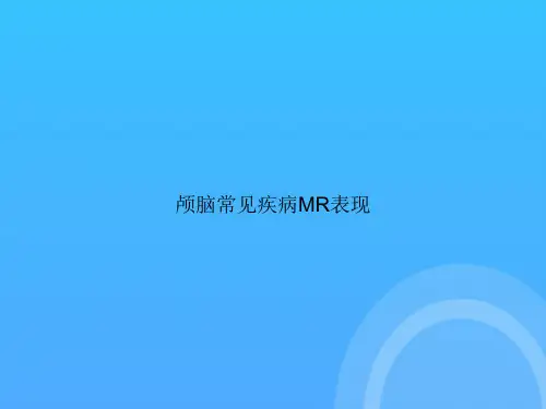 颅脑常见疾病MR表现