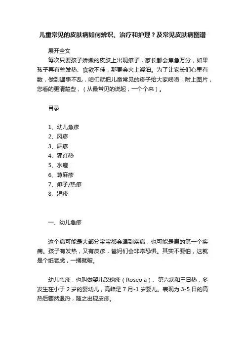 儿童常见的皮肤病如何辨识、治疗和护理？及常见皮肤病图谱