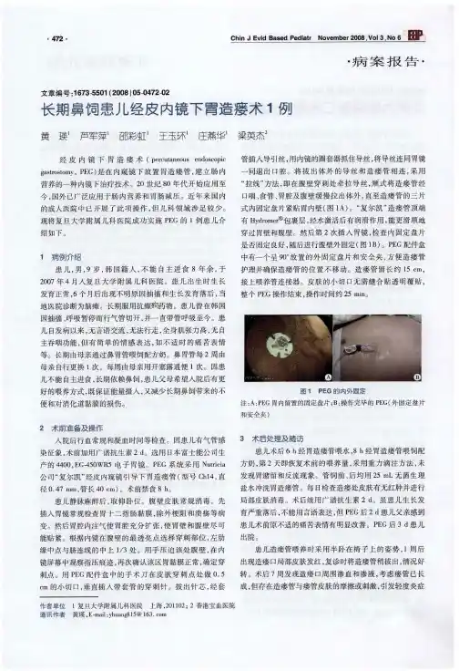 长期鼻饲患儿经皮内镜下胃造瘘术1例