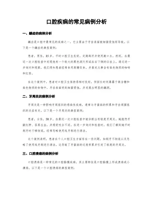 口腔疾病的常见病例分析