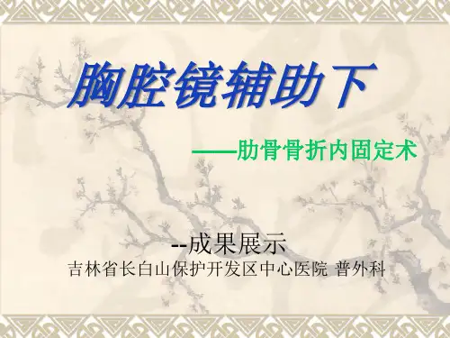 肋骨骨折内固定术PPT