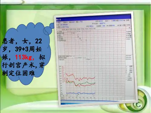 浅谈肥胖患者的麻醉处理ppt课件