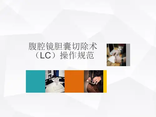 腹腔镜胆囊切除术操作规范