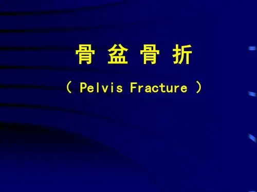 骨盆骨折教学幻灯课件