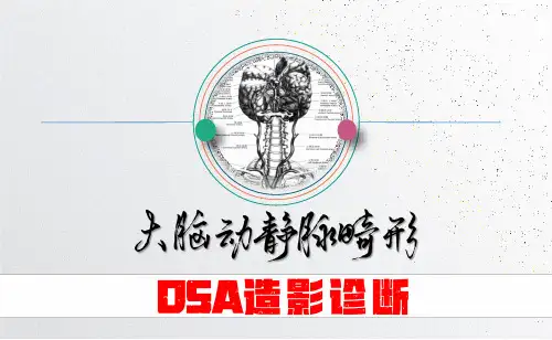 大脑动静脉畸形DSA造影诊断