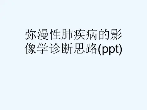弥漫性肺疾病的影像学诊断思路(ppt)