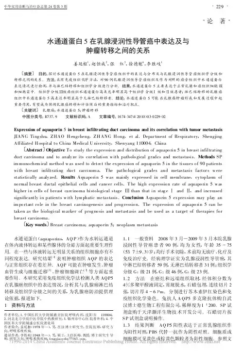 水通道蛋白5在乳腺浸润性导管癌中表达及与肿瘤转移之间的关系_姜廷枢