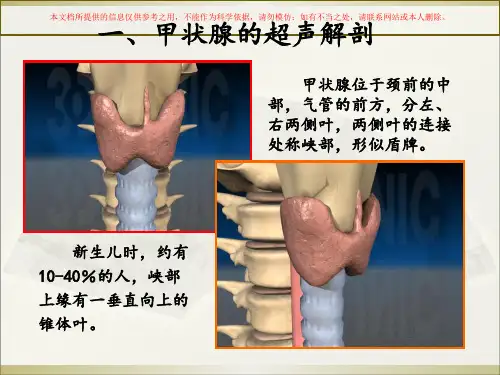 甲状腺超声诊断培训课件