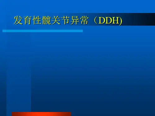 25发育性髋关节异常PPT课件