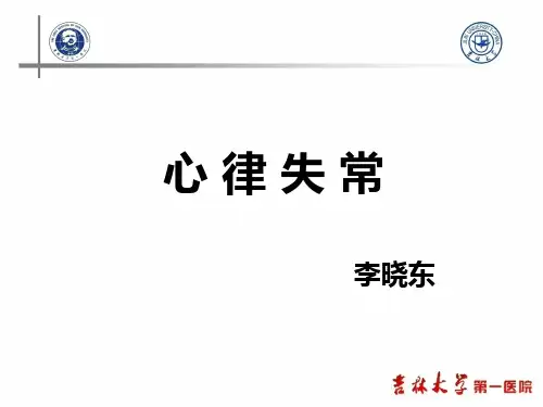 心律失常