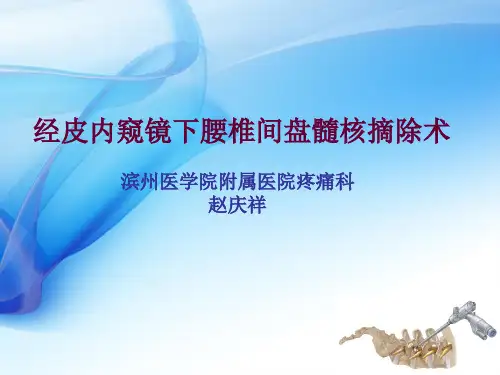 脊柱内镜技术