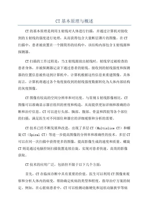 CT基本原理与概述