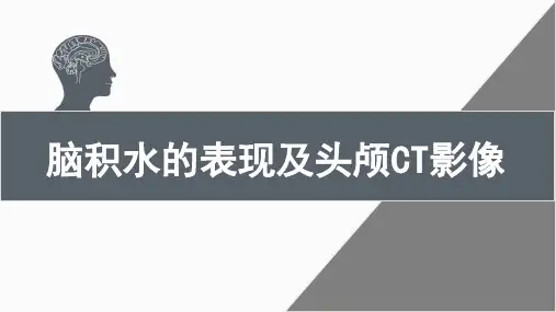 脑积水表现及CT影像
