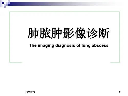 肺脓肿影像诊断PPT