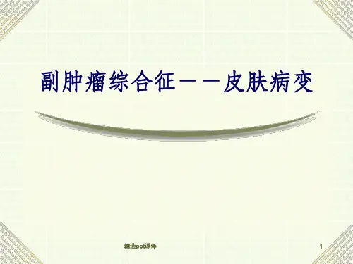 副肿瘤综合征皮肤病变ppt课件