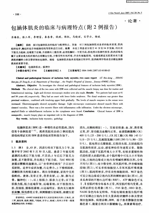 包涵体肌炎的临床与病理特点(附2例报告)