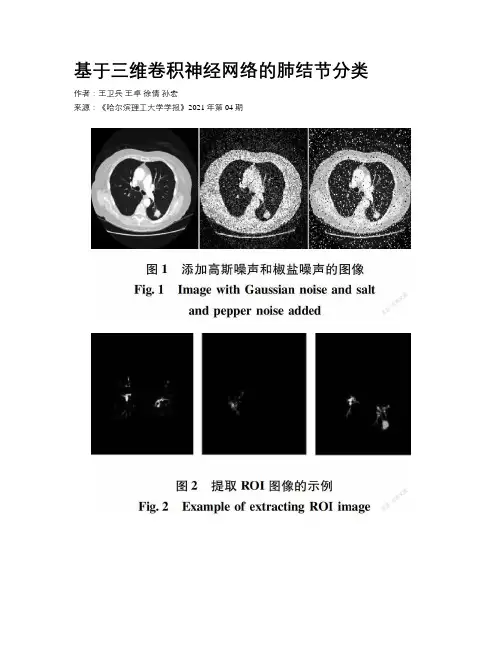 基于三维卷积神经网络的肺结节分类