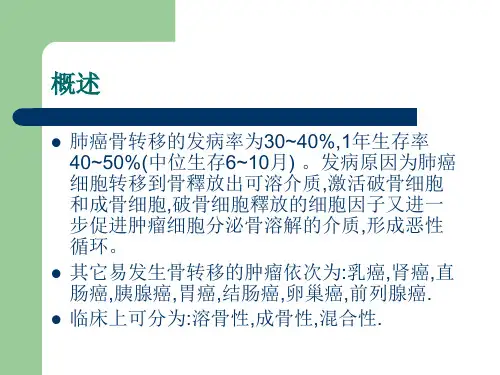 肺癌骨转移诊治实习