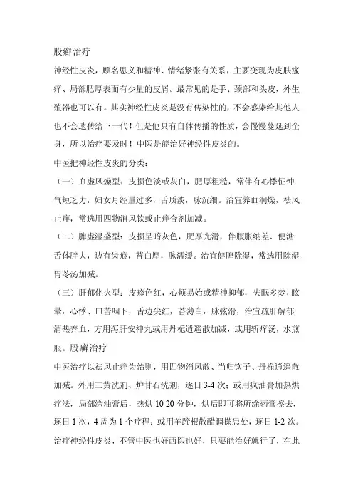 股癣治疗