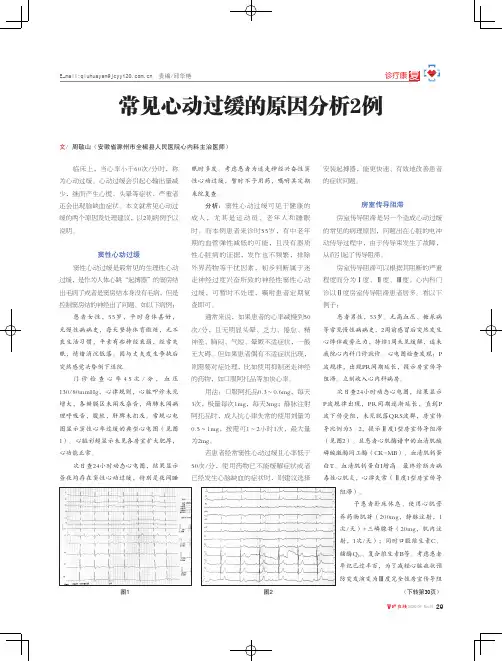 常见心动过缓的原因分析2例