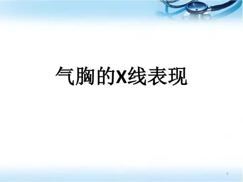 气胸的X线表现PPT医学课件