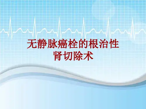手术讲解模板：无静脉癌栓的根治性肾切除术