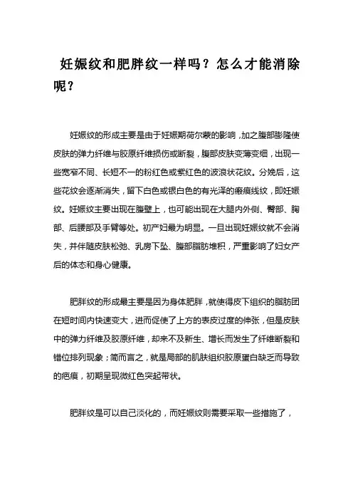妊娠纹和肥胖纹一样吗？分别怎么祛除呢？