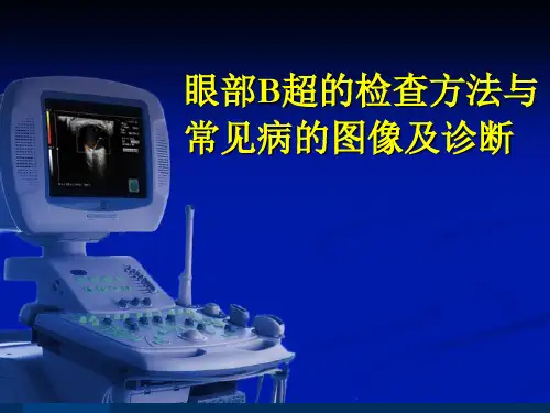 眼部B超常见病的图像及诊断[2]