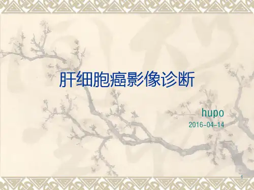 肝细胞癌影像诊断PPT课件