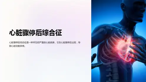 心脏骤停后综合征