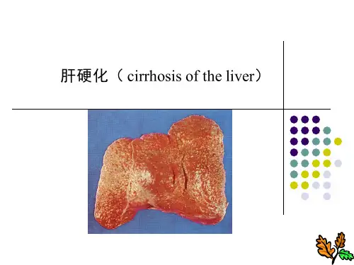 病理学肝硬化