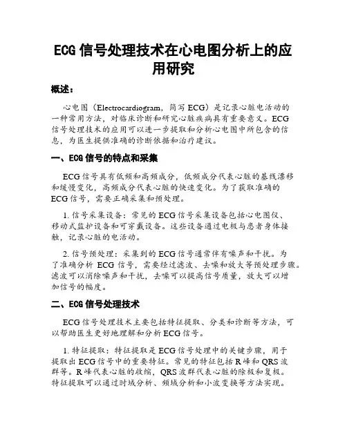 ECG信号处理技术在心电图分析上的应用研究