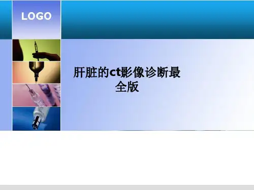 肝脏的ct影像诊断最全版