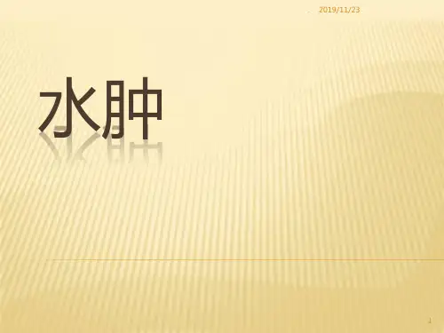 中医内科学 水肿、淋证、癃闭PPT课件