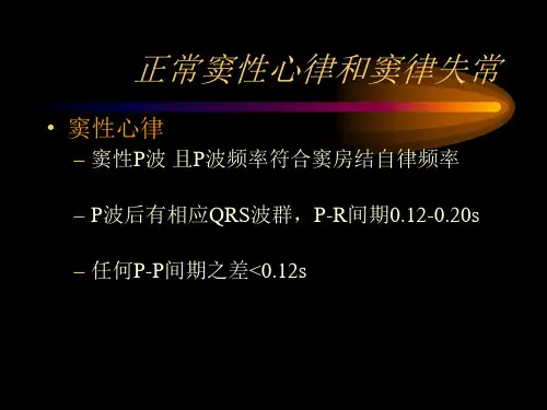正常窦性心律和窦律失常