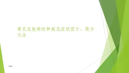 常见皮肤病的种类及症状图片、简介大全