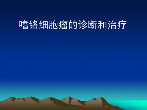 嗜铬细胞瘤的诊断和治疗
