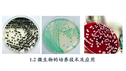 高中生物选择性必修三《微生物的培养技术及应用》